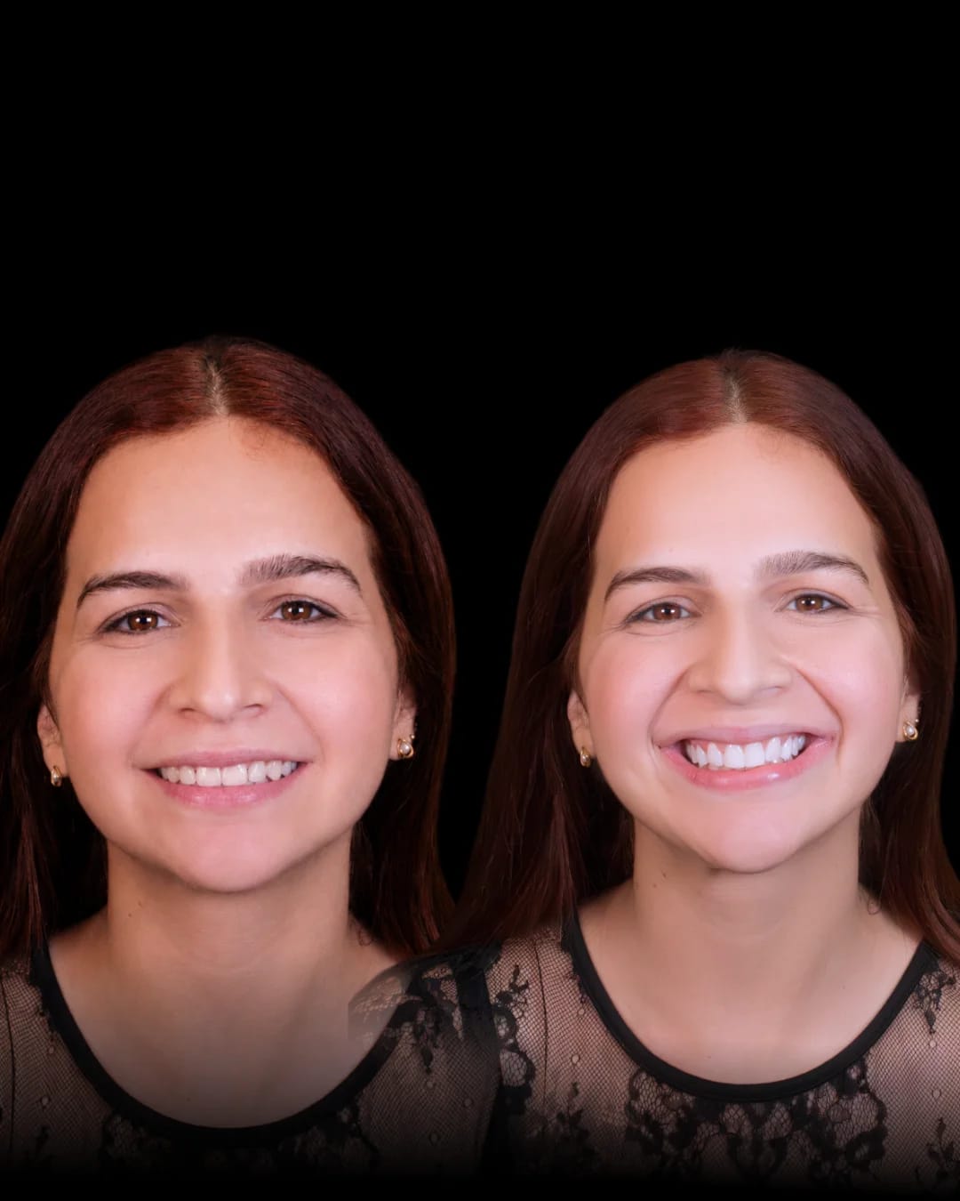 Caso Clínico 1 - Valo Dental Studio