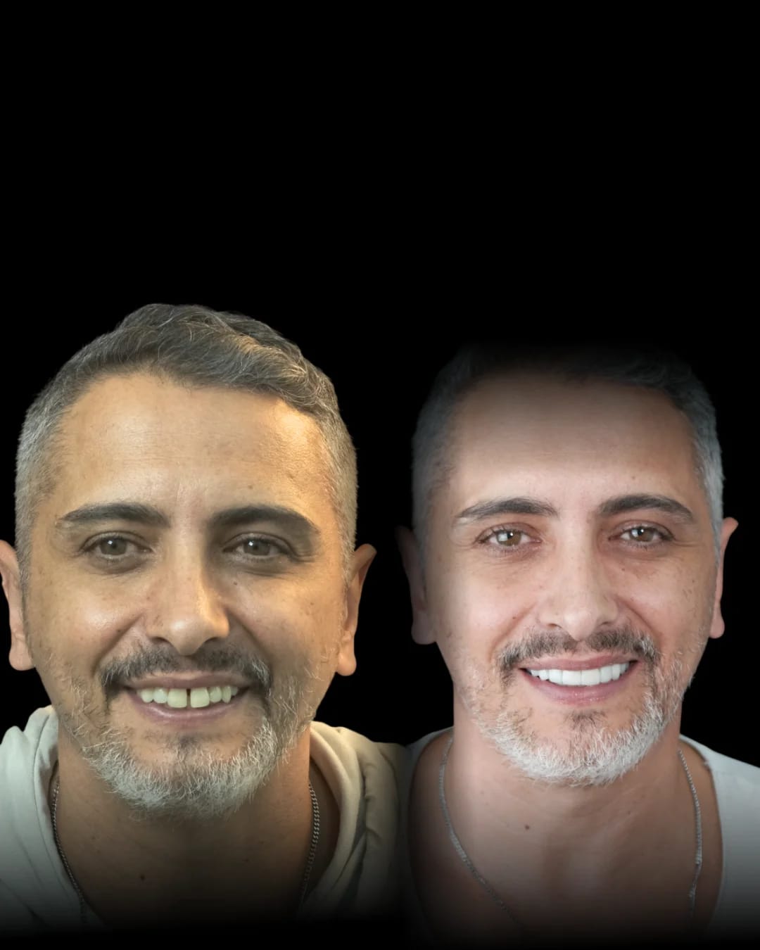Caso Clínico 1 - Valo Dental Studio