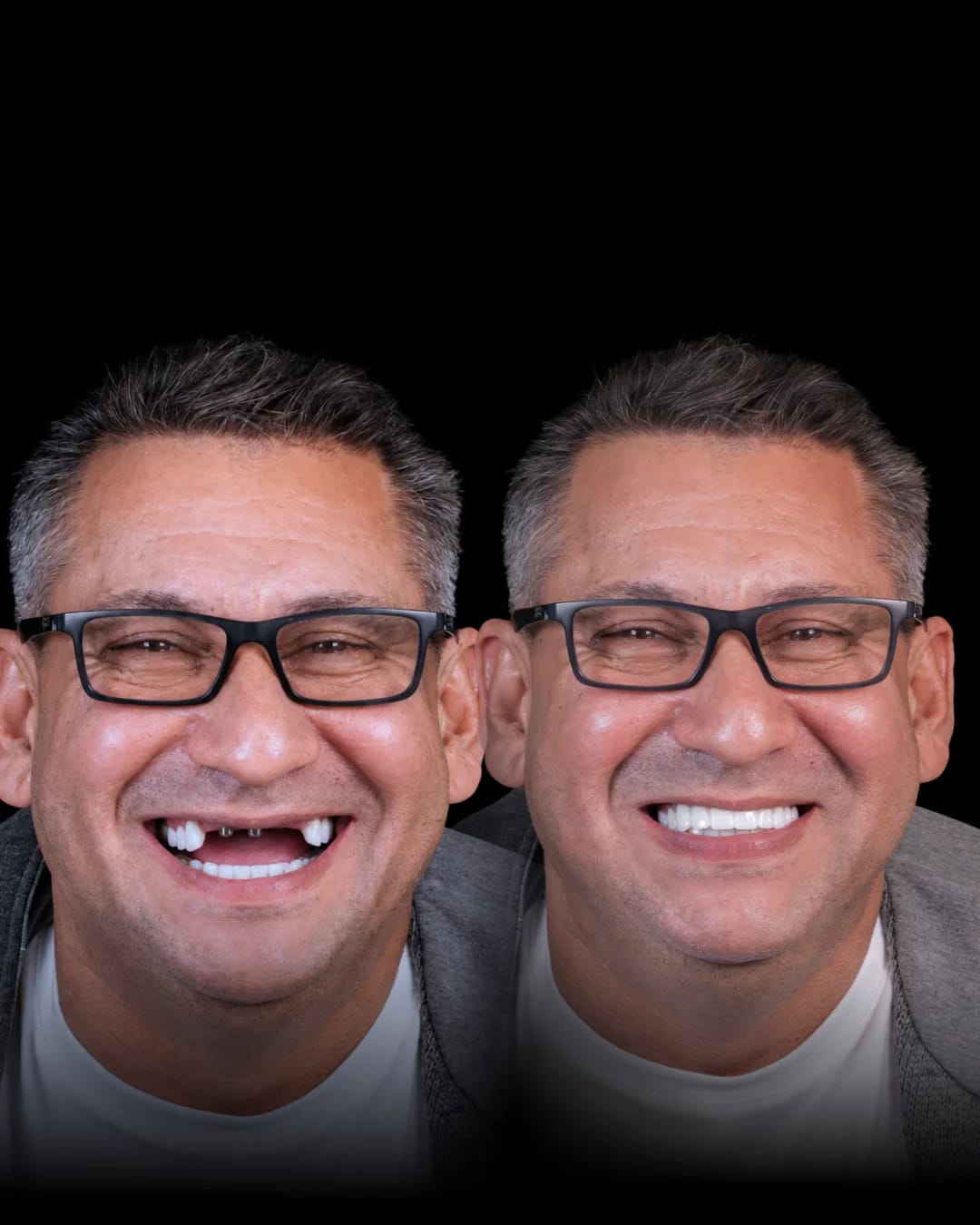 Caso Clínico 1 - Valo Dental Studio