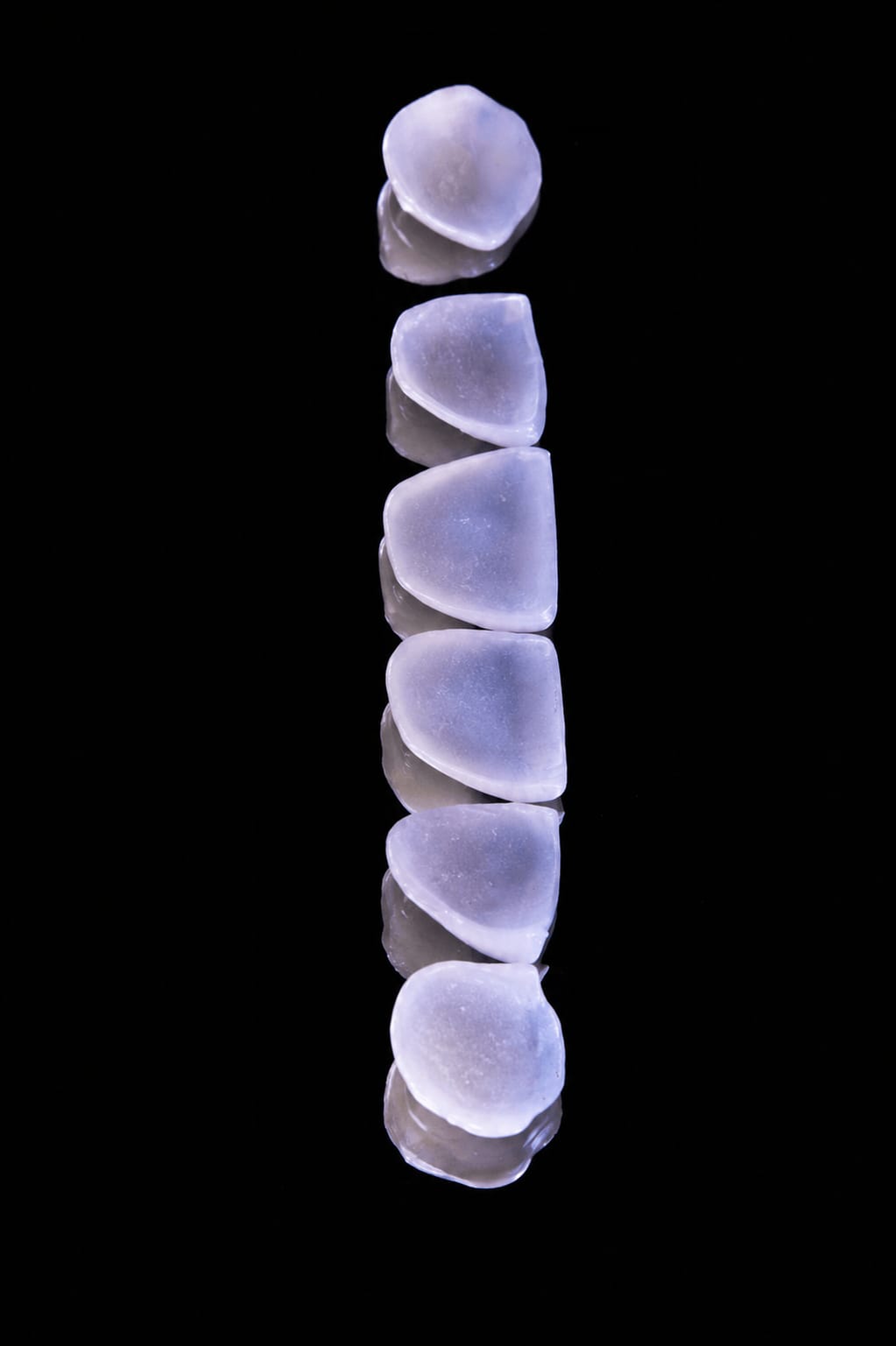 Beneficios Carillas - Valo Dental Studio
