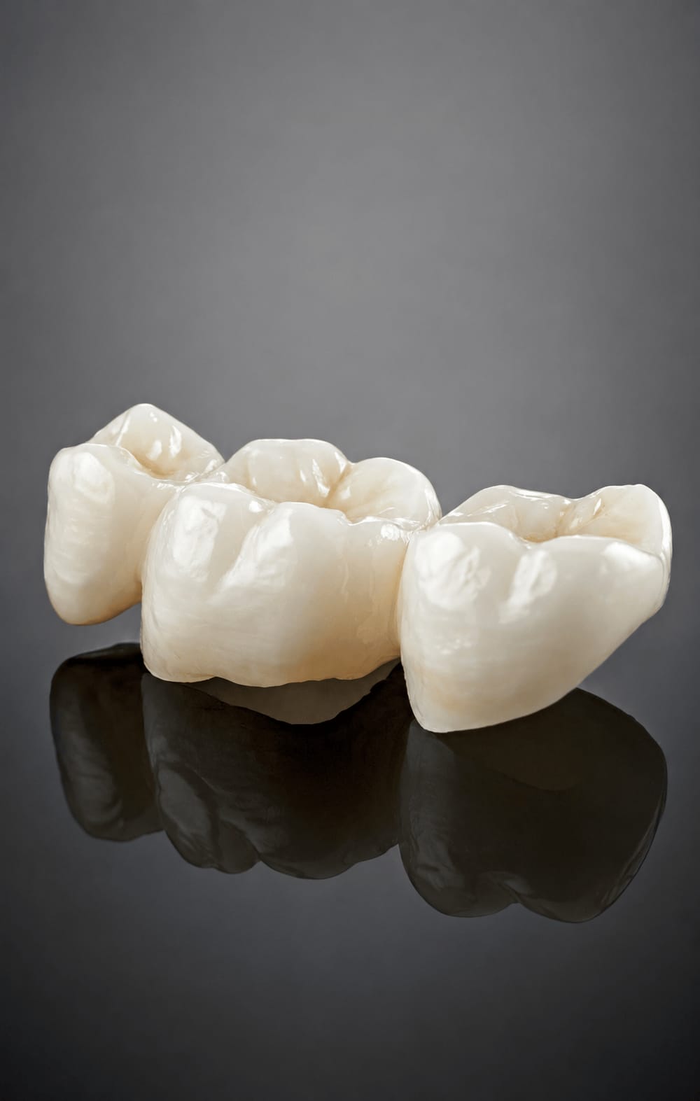 Crowns Benefits - Valo Dental Studio